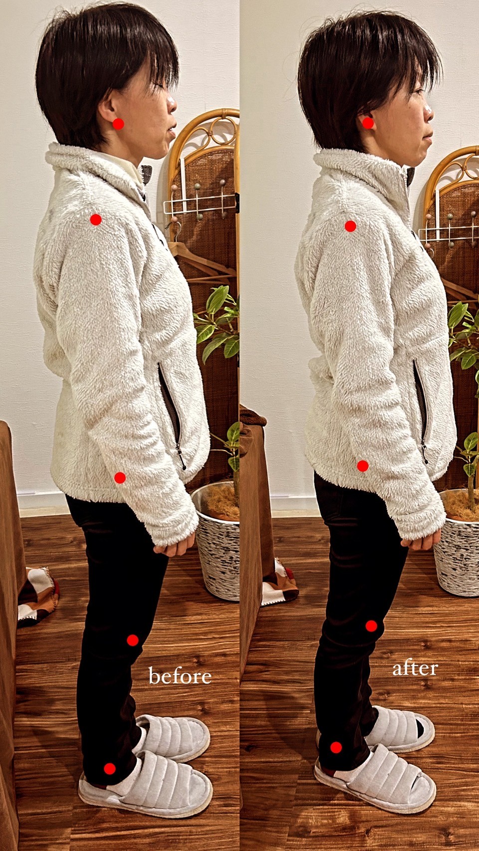 施術前後の立ち姿の比較